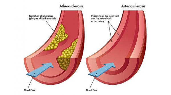 How To Cleanse Your Body With This Extraordinary Recipe