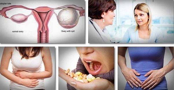 cure-for-cysts