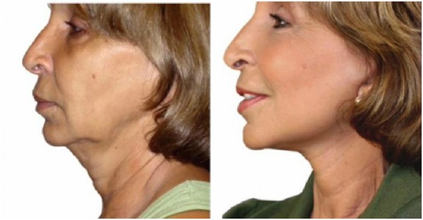 How To Look Younger 1