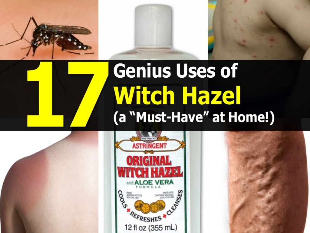17 Genius Uses of Witch Hazel