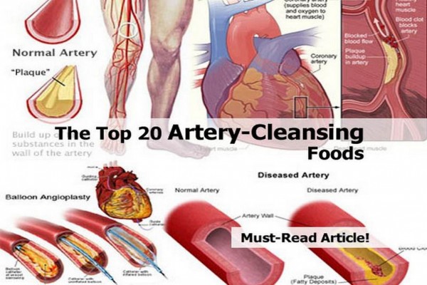 Top 20 Artery-Cleansing Foods