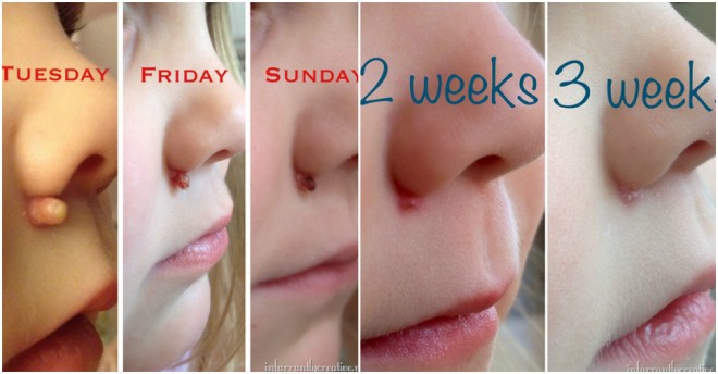 Essential Oil Health