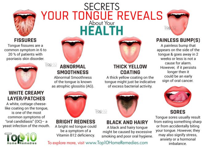 what-your-tongue-says-about-your-health-1