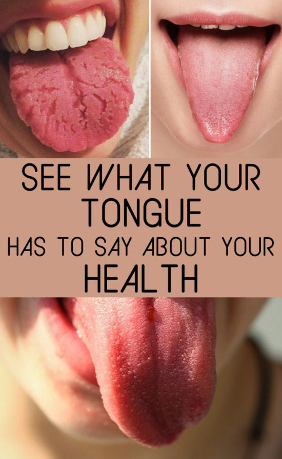 what-your-tongue-says-about-your-health-2